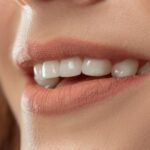 Imagem mulher sorrindo com dentes bonitos