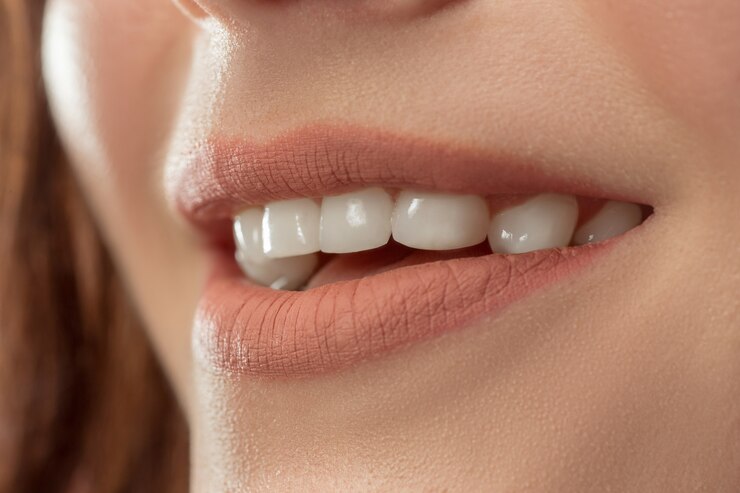 Imagem mulher sorrindo com dentes bonitos