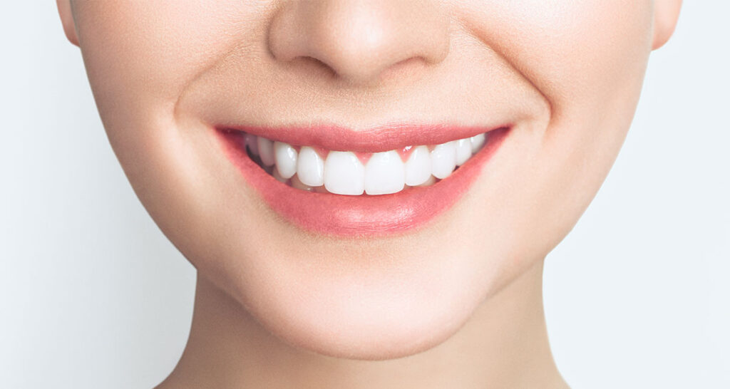 Happy smiling woman with cosmetic dentistry treatment