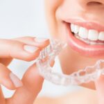 mulher sorrindo usando aparelho invisalign